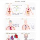 심근병증진단비보장 특별약관 이미지