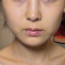 생그린화장품 | 바르는보톡스 생그린 보툴링클 프라임앰플 사용후기