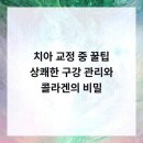 범석영치과의원 네이버블로그