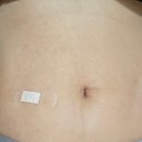 나래이비인후과의원 | 38살 시험관 주사 시작(상봉 마리아 유래미 선생님 진료)