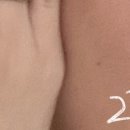 40 | 화이트태닝 내돈내산 40회 후기