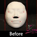 경락마사지 이미지