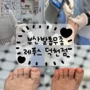 덕천빌딩 | 부산발톱무좀 두꺼워지는 발톱 변색된 발톱 스케일링 후기 레푸스부산덕천점 1회차 만족