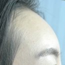 비엔에프의원 이미지