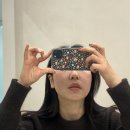 대구 리쥬란HB플러스 2cc 통증, 후기, 효과