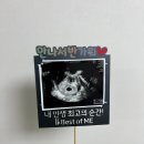 베스트오브미 PGT 통배 2개 이식 +13일 ~ +20일 첫 초음파 후기 5주3일