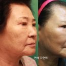 카프로닥터 이미지