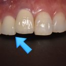 CORE 치과기공소 이미지