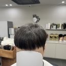 속구랑 | 창원 헤어증모술 후기 김해 남자 앞머리탈모