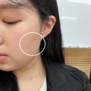 라메종피부과의원 네이버블로그