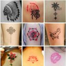 신레이저 이미지