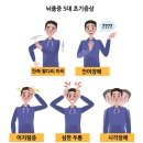 뇌출혈, 뇌경색에 특효혈자리 이미지