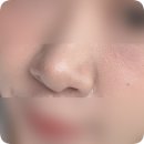 (주)라인정보통신 | 부산 서면역 피부과추천 코조각주사 3회 l 자연스럽게 코라인 정리 후기