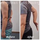 피지오짐 이미지