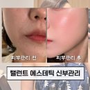 탤런트 | 홍대 피부관리 탤런트에스테틱 신부관리 만족 후기 웨딩관리 끝판왕