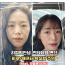 지전 | 지전분한히피펌 안녕👋단발빈티지펌으로 변신(첫방문50%할인)