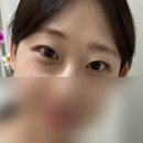 라은 | ꒰১공덕 속눈썹펌 정착한 곳 ‘라은 속눈썹’ 왕 추천하는 후기໒꒱