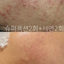 거대토끼뷰티