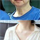 (주)베프 | 베프도 놀란 가슴팍주름 목주름관리법 신상 커런트바디 LED 목 가슴 마스크 2세대