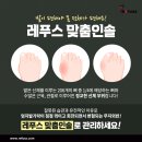 레푸스 춘천후평점