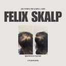 채도스칼프 이미지