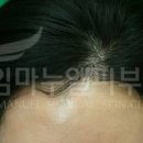 임마누엘헤어