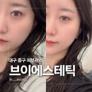 오아시스 메디칼 | 대구 중구 피부관리 브이 에스테틱 메디컬 리프팅 오마카세로 날렵한 턱선 만들기