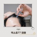피알시대 | 두피 자생앰플 찾다가 정착한 리필드 엑소좀77 앰플 4주 사용 후기