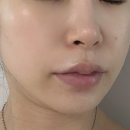 아보피부관리