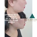 충주동원에너지 | [공지] 리프팅시술추천) 충주 피부관리 충주리프팅 스킨케어No1 예신관리 리프팅은 젤라뷰티크