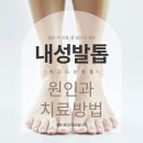 세한메디칼 | 은평구 증산동 내성발톱 자가치료 실패 했다면 치료 방법 바꿔주세요