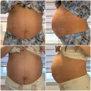 신성동물병원 | 자연분만, 제왕절개 둘 다 해본 고위험 산모 출산후기