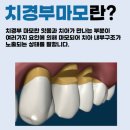 엔젤치과의원 네이버블로그