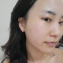 칠곡 피부관리 아르떼 두피탈모센터 칠곡점 트러블 진정 수분관리 후기