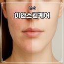 천안 백석동피부관리 홍조 케어 잘하는곳 이안스킨케어 솔직후기