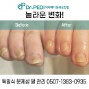 닥터페디(동래온천점) | 양산발톱관리, 닥터페디 동래온천점에서 제대로 받아보세요