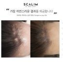 두피채움연구소