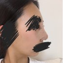 로에성형외과의원 | 가짜 인생 가짜코. 가짜코의 역사 / 내돈내산 가짜코 후기