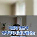 SU연세안과의원 네이버블로그