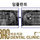 바오치과기공소 이미지