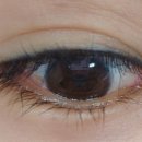 와이엠메디칼 이미지