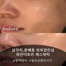 굿파인더 | [문배동 피부관리샵] 상체, 피부 올인원 관리 '파인더트리 에스테틱' 탄력관리 후기