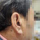 광명우리보청기 이미지