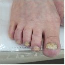 136네일(nail)