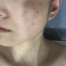 익산피부관리 에스테틱 추천 킴스스킨케어