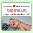 자해흉터 레이저 치료 후기, 연세스타피부과신촌