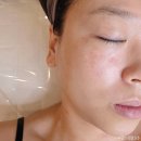 배곧피부관리 나름답다 시흥배곧본점 피부재생 관리 후기