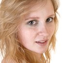 엑셀브이의원 이미지