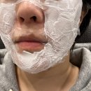 소피아 에스테틱 | 이중턱살 리프팅 효과 좋은 슈링크 유니버스 300샷 후기!