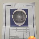 이노야드 두상교정센터 석촌호수 이미지